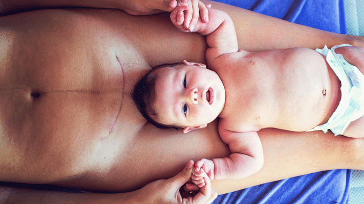 Baby laying on birth parent's lap with C Section scar